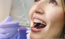 стоматологическая клиника fresh dental на пятницком шоссе изображение 16 на проекте infodoctor.ru