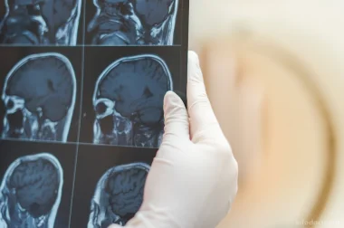 МРТ головного мозга + ангиография артерий и вен 6000руб!